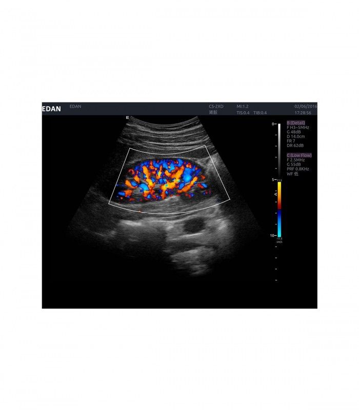 Échographes Echographe portable AX8 + 1 sonde