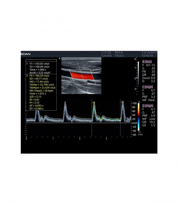 Échographes Echographe portable AX8 + 1 sonde