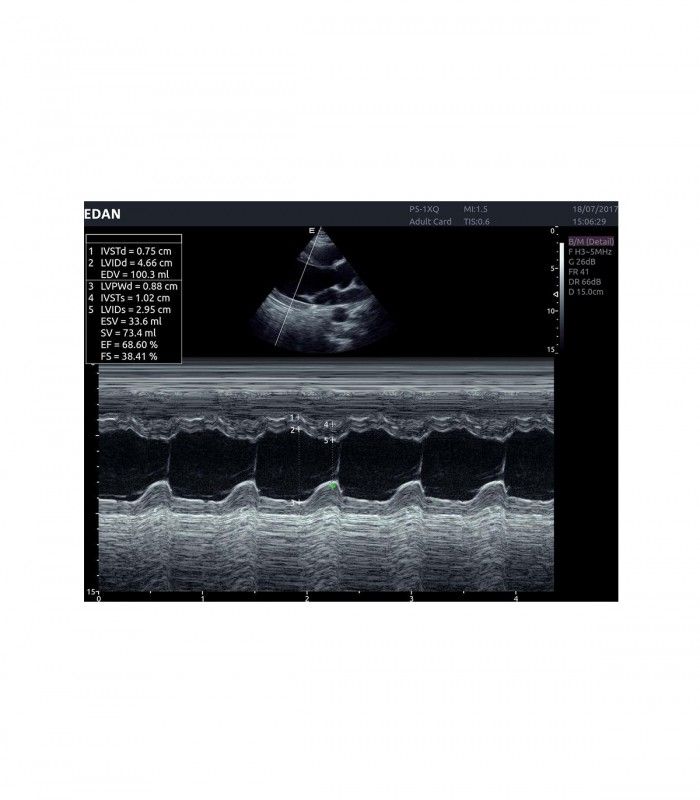 Échographes Echographe portable AX8 + 1 sonde