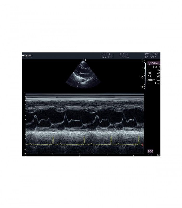 Échographes Echographe portable AX8 + 1 sonde