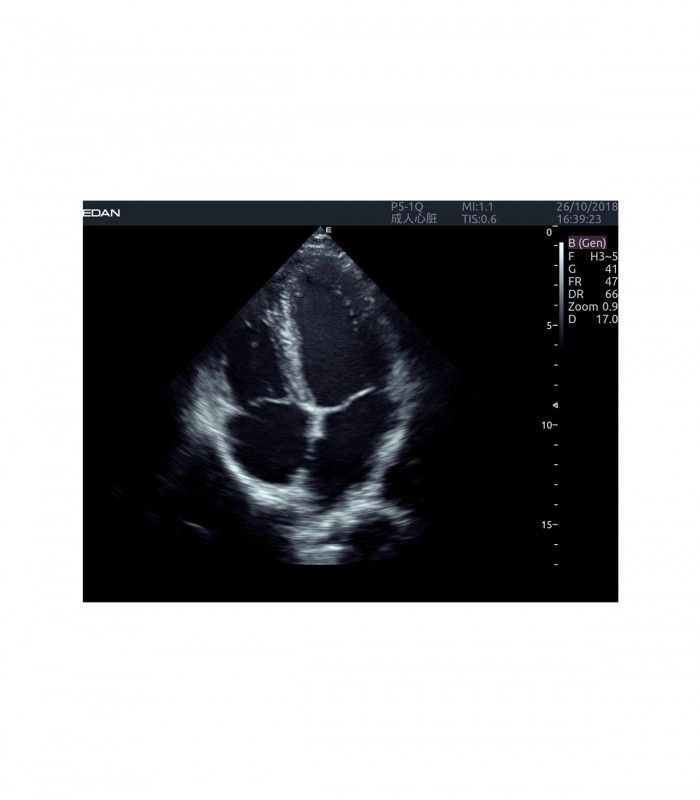 Échographes Echographe portable AX8 + 1 sonde