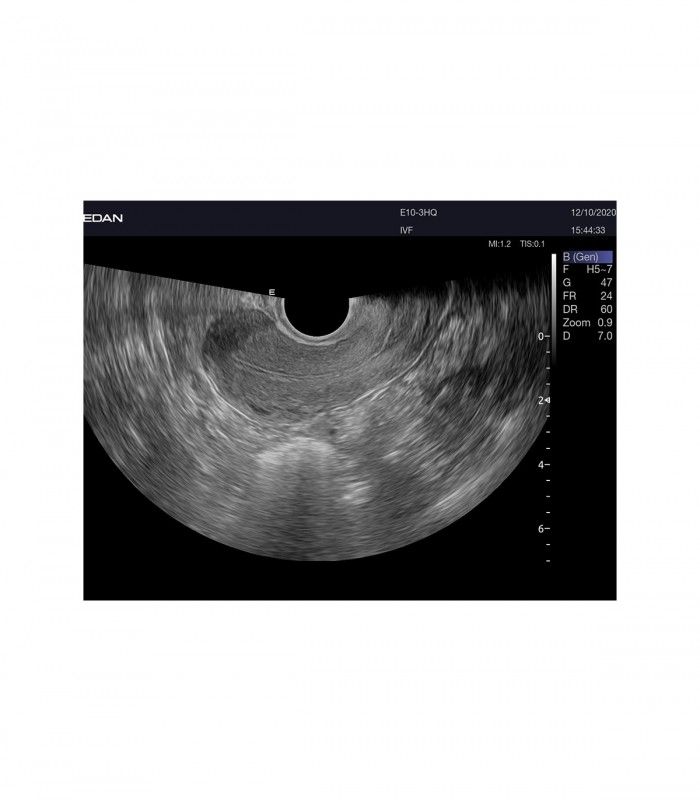 Échographes Echographe portable AX8 + 1 sonde