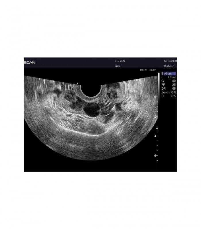 Échographes Echographe portable AX8 + 1 sonde