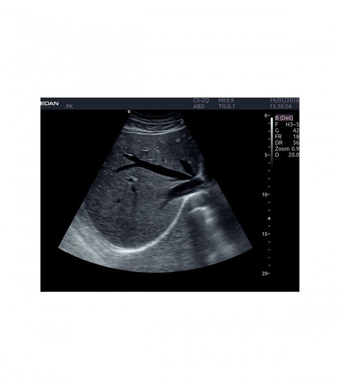 Échographes Echographe portable AX8 + 1 sonde