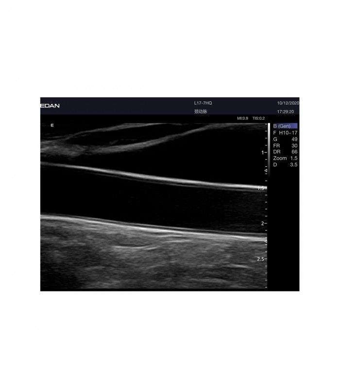 Échographes Echographe portable AX8 + 1 sonde