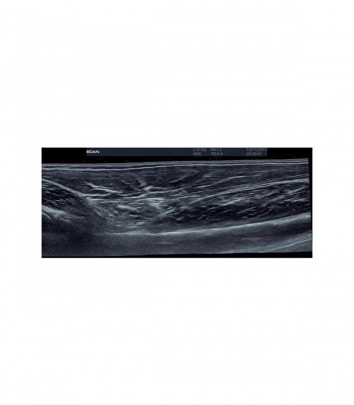 Échographes Echographe portable AX8 + 1 sonde