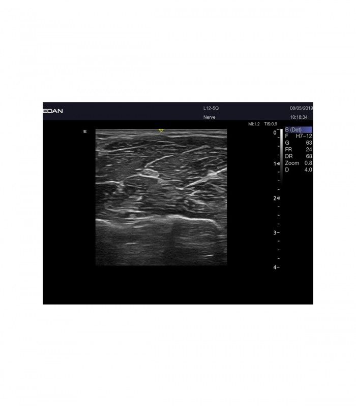 Échographes Echographe portable AX8 + 1 sonde