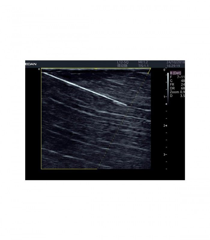 Échographes Echographe portable AX8 + 1 sonde