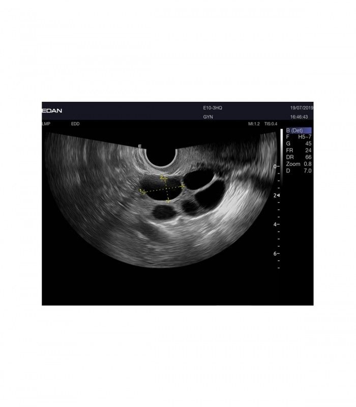 Échographes Echographe portable AX8 + 1 sonde
