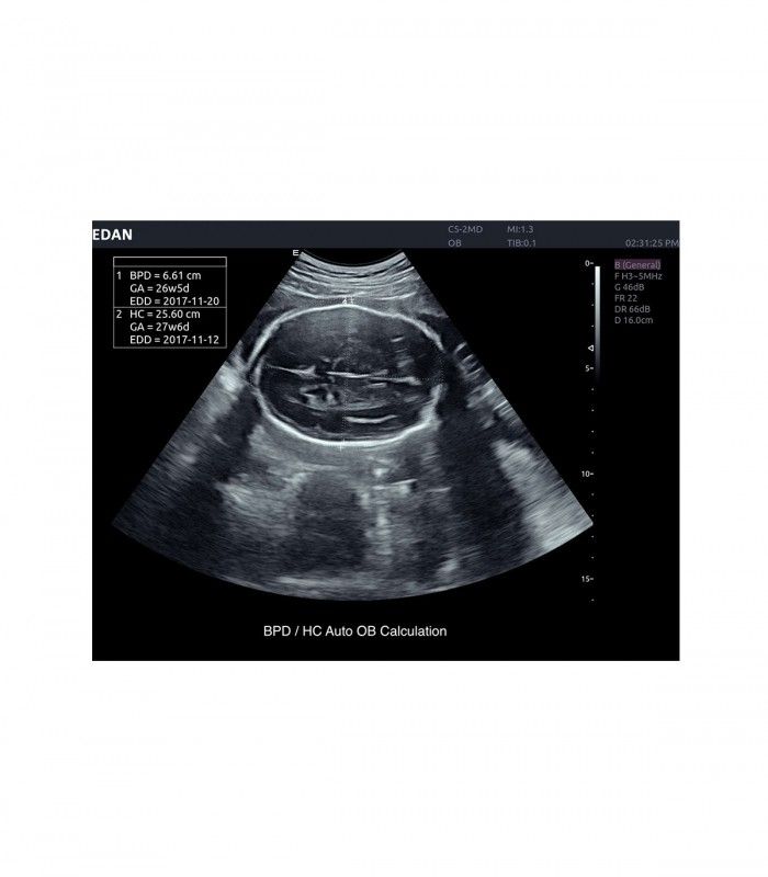 Échographes Echographe portable AX8 + 1 sonde