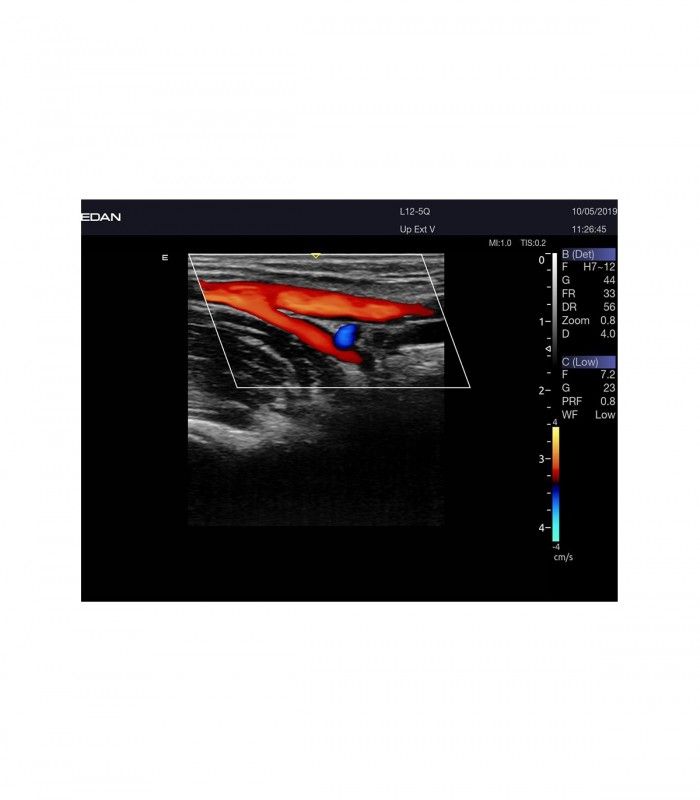 Échographes Echographe portable AX8 + 1 sonde