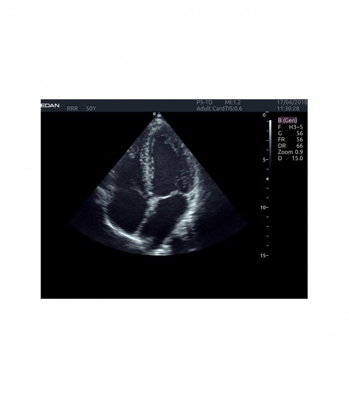 Échographes Echographe portable AX4 + 1 sonde