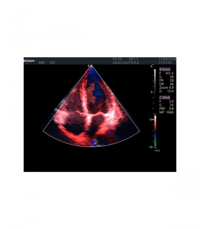 Échographes Echographe portable AX4 + 1 sonde