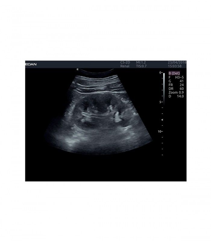 Échographes Echographe portable AX4 + 1 sonde