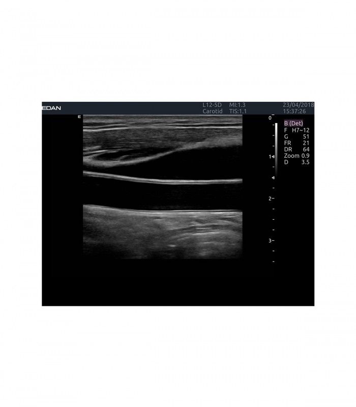 Échographes Echographe portable AX4 + 1 sonde