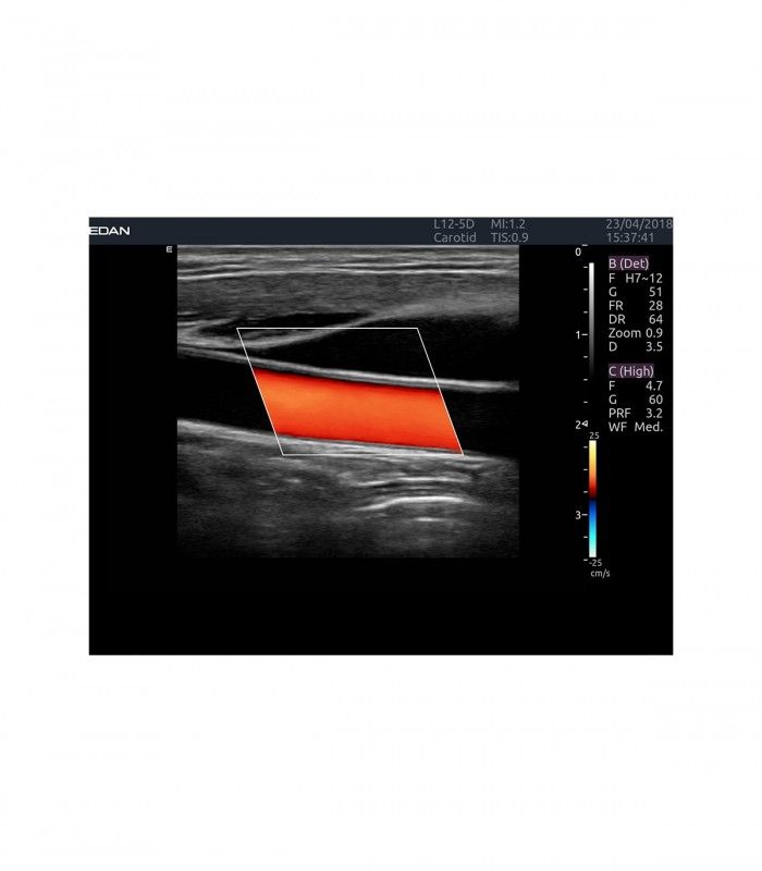 Échographes Echographe portable AX4 + 1 sonde