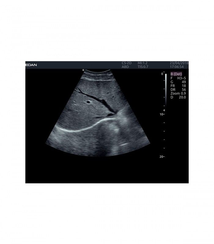Échographes Echographe portable AX4 + 1 sonde