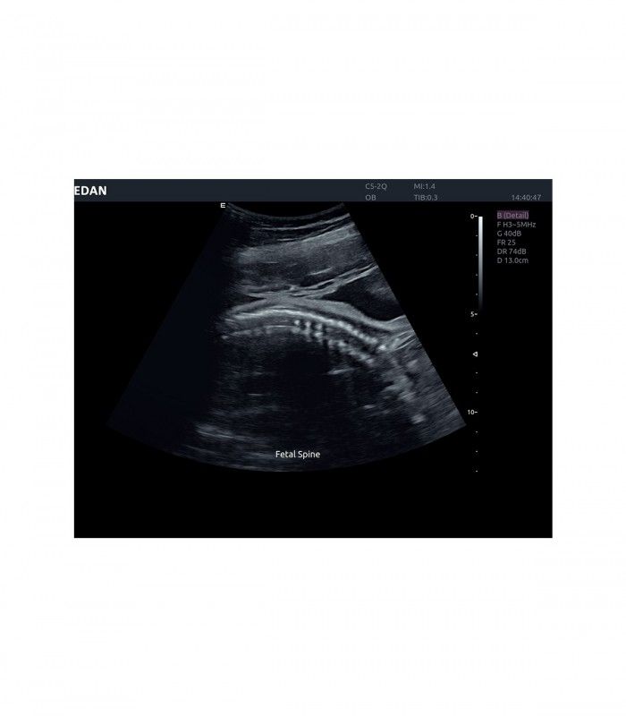 Échographes Echographe portable AX4 + 1 sonde