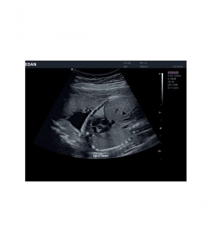 Échographes Echographe portable AX4 + 1 sonde