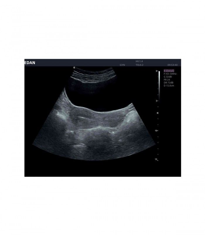 Échographes Echographe portable AX4 + 1 sonde