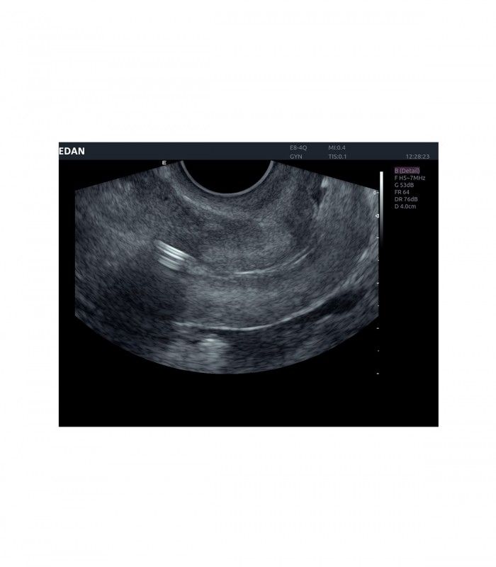 Échographes Echographe portable AX4 + 1 sonde