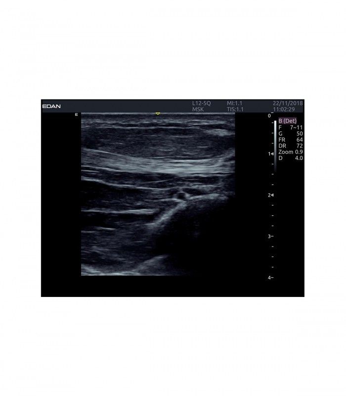 Échographes Echographe portable AX4 + 1 sonde