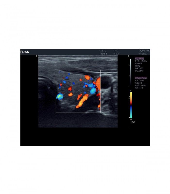 Échographes Echographe portable AX4 + 1 sonde