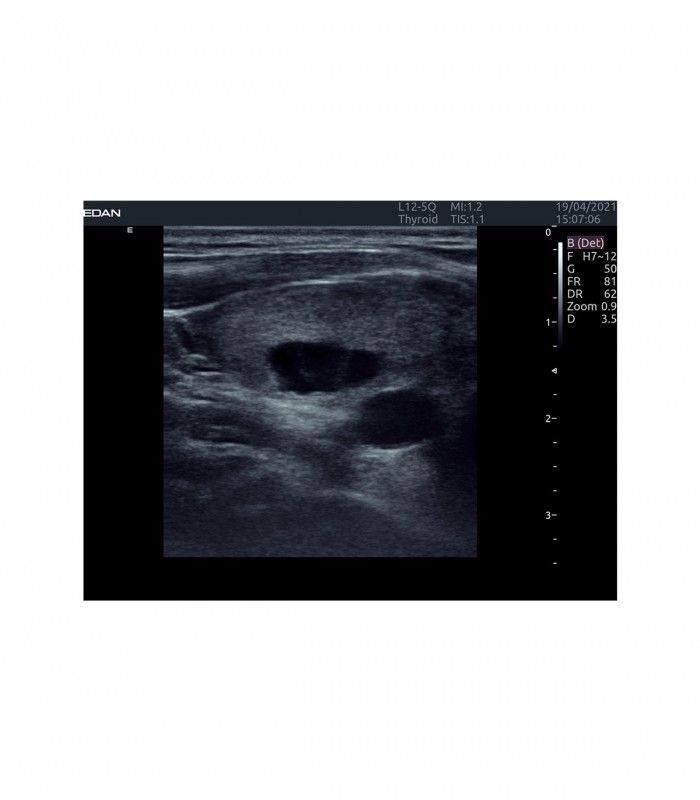 Échographes Echographe portable AX4 + 1 sonde
