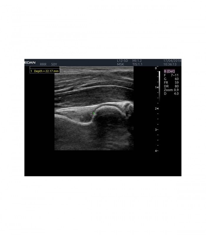 Échographes Echographe portable AX4 + 1 sonde