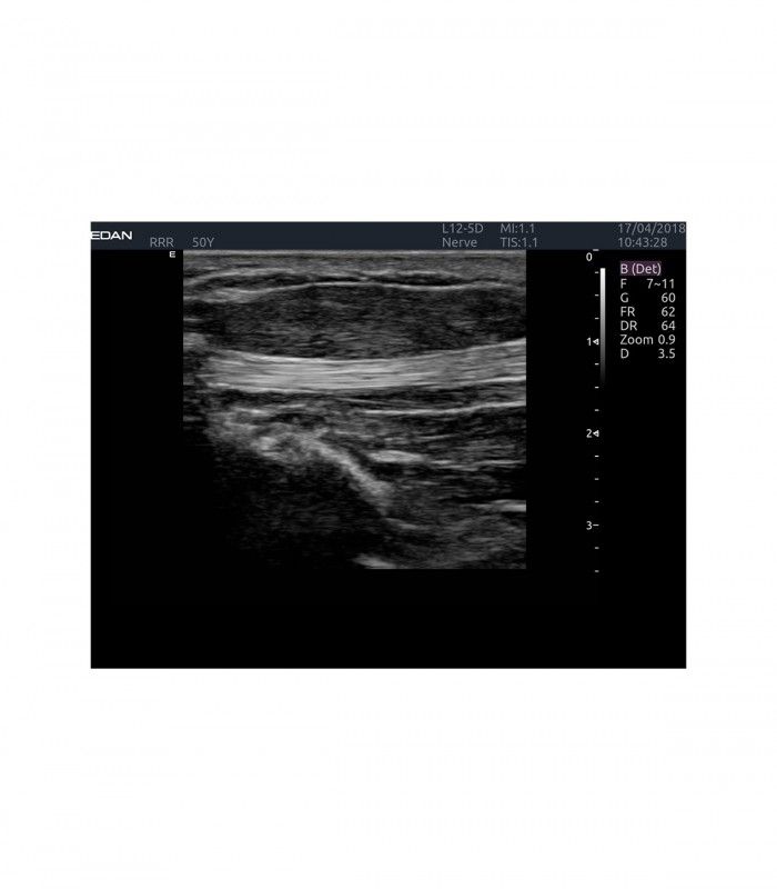 Échographes Echographe portable AX4 + 1 sonde