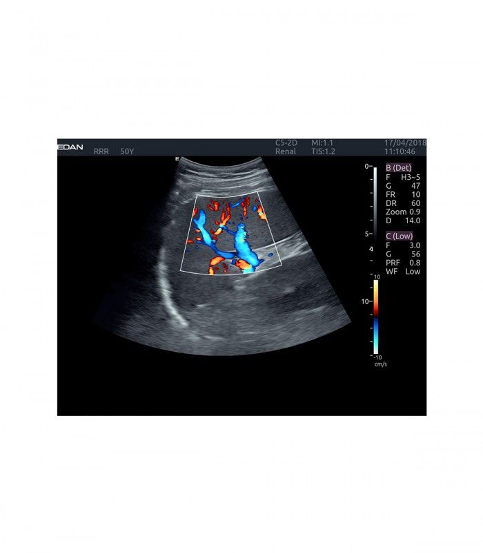 Échographes Echographe portable AX4 + 1 sonde