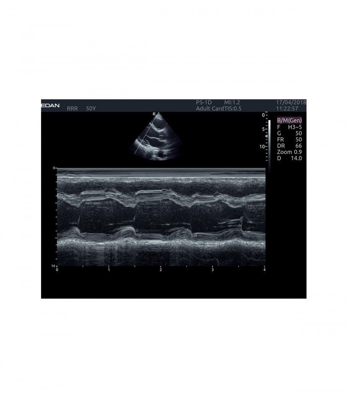 Échographes Echographe portable AX4 + 1 sonde