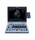Échographes Pack Echographe portable U60 + 1 sonde