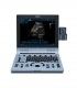Échographes Pack Echographe portable U60 + 1 sonde